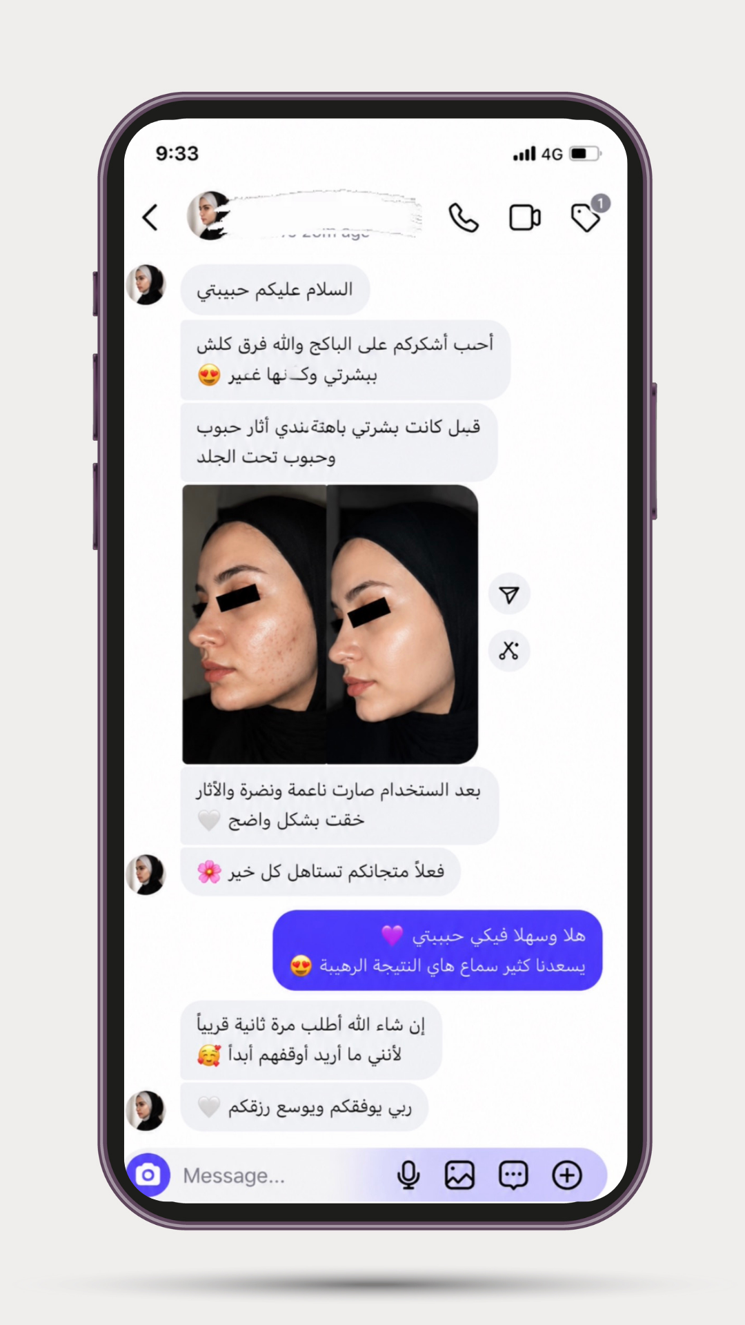 Five-star customer review for Derma Botox skincare products.