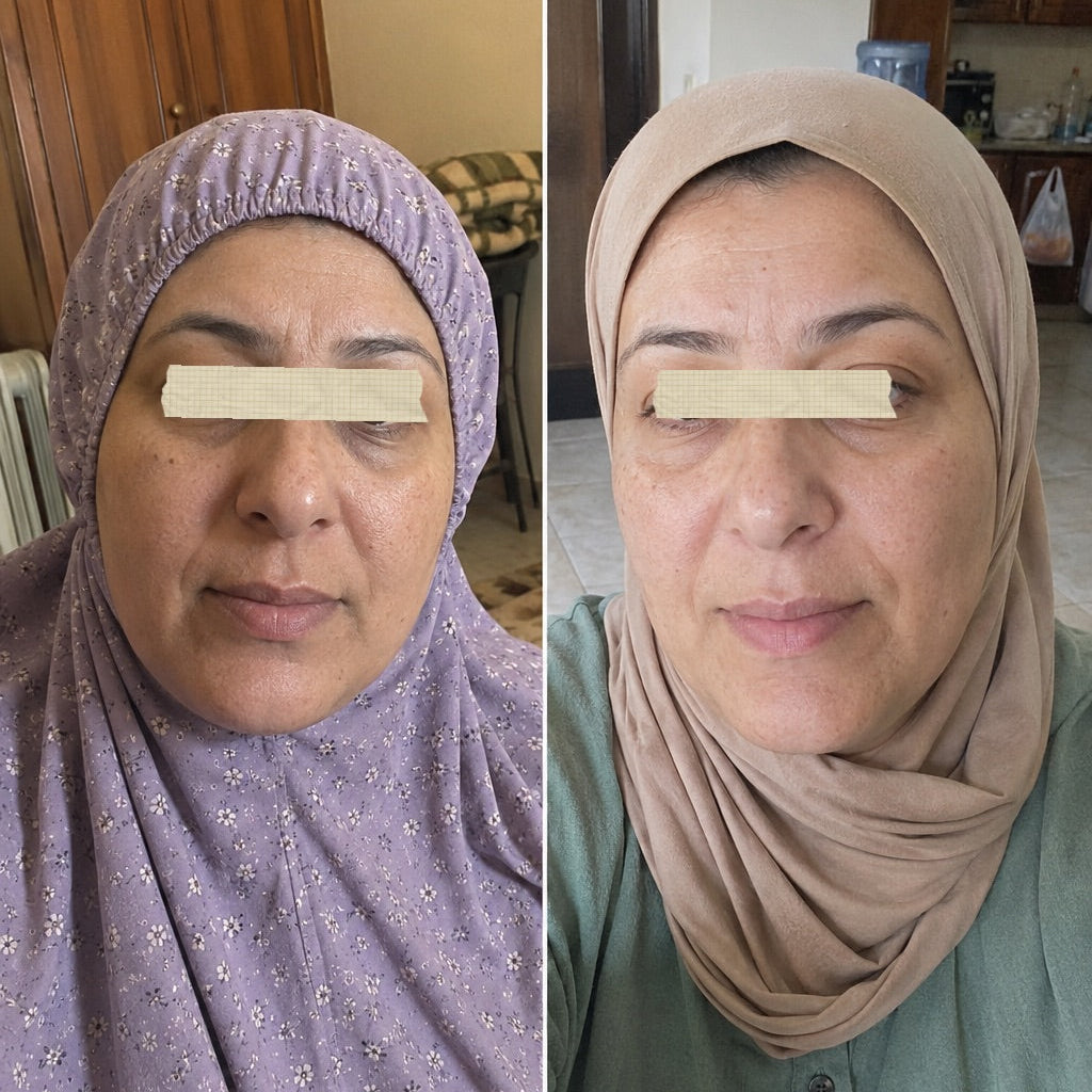 Before and after using the Derma Botox skincare routine, showing brighter, smoother and more even-looking skin.